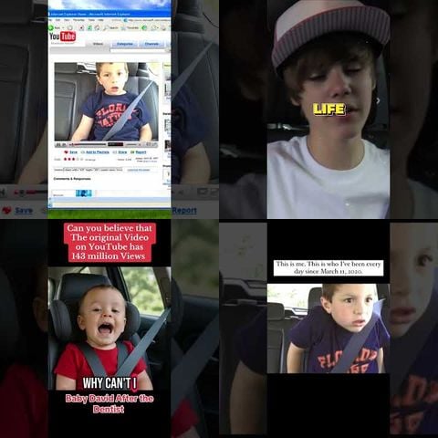 David After Dentist Viral thumbnail