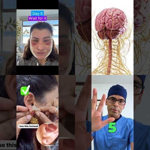 Epic Ear Weight Fails thumbnail