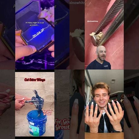 Epic Toe Ring Fails thumbnail