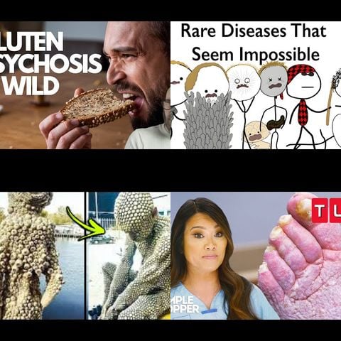 Strange Medical Conditions thumbnail